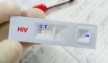 Στις 5.282 οι εξετάσεις για HIV την τελευταία 10ετία από το Cyprus Checkpoint